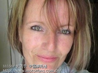 克莱恩莱文综合症: 啥时候到中国?一天ML10多