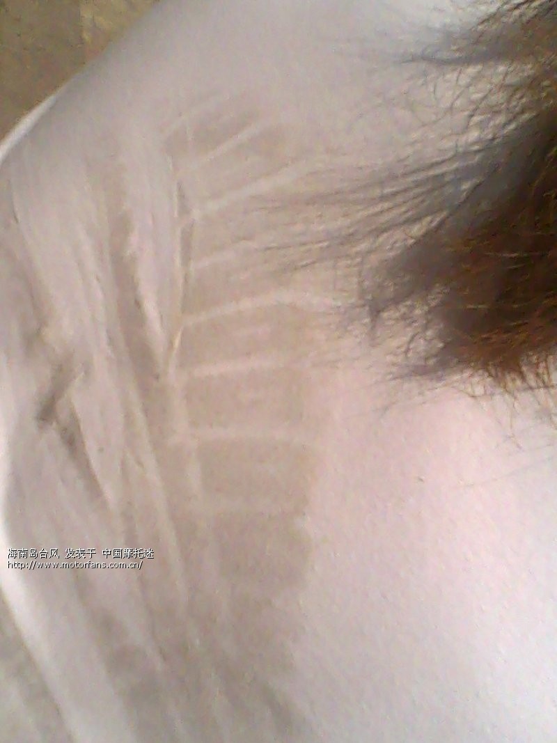 3月19日被河南人撞车打架前后详细处理报道 -